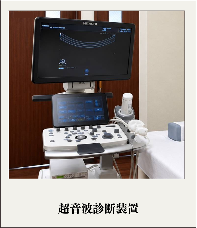 超音波診断装置